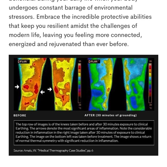 Grounding & Earthing Barefoot Ankle Strap
Sandals for Women - Picture 10 of 12